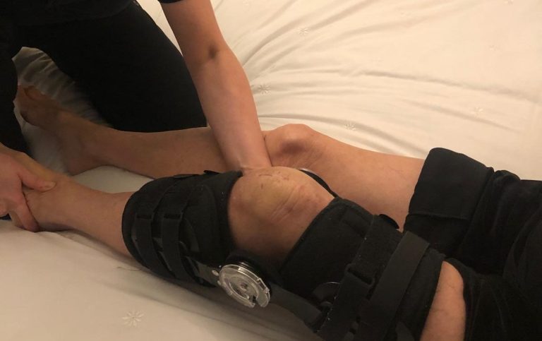Post surgery image A person receiving treatment on their knee, wearing a knee brace.